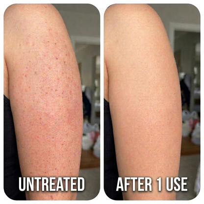 Instant Strawberry Skin Fix